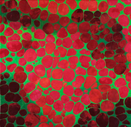 Photo: Virginia Abrams, Lipid Cells, 2009