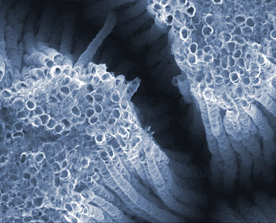 titanium dioxide nanotubes, image courtesy Argonne National Laboratory