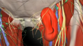 Hernia animation