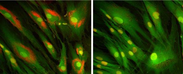 Untreated and treated cells from NPC1.