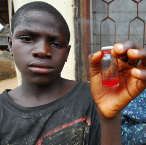 In Nasarawa North in Nigeria, 12-year-old Dauda Usman holds a sample of his urine, which is red with blood, a sign of schistosomiasis.