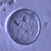 Microscope image of an oocyte.