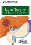 Liver Tumors: A Patient's Guide