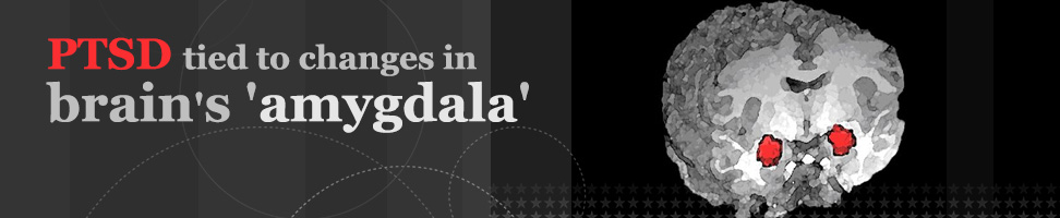 PTSD tied to changes in brain's 'amygdala' 
