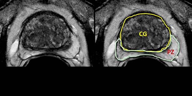 Prostate Collection sample image