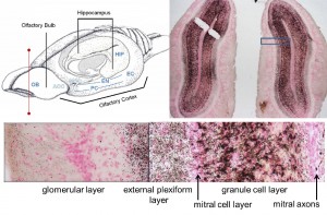 domoic acid-damaged rat brain