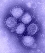 Imagen del virus de la influenza H1N1