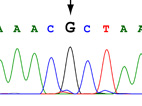 chart of DNA sequence shows a mutation in the letter G