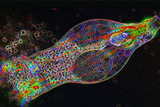 (Bdelloid) rotifer Philodina roseola