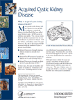 Acquired Cystic Kidney Disease publication thumbnail image