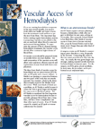Vascular Access for Hemodialysis publication thumbnail image