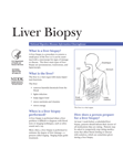 Liver Biopsy publication thumbnail image