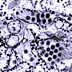 Transmission electron micrograph of dengue virus particles in tissue.