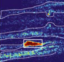 Microscope image showing several nerve fibers, one with a bright fluorescent signal.