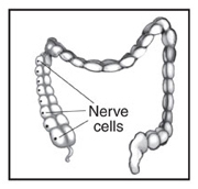 Drawing of long-segment HD. Nerve cells are labeled. 