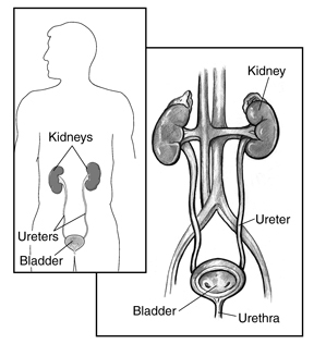 Front-view drawing of a normal urinary tract with kidney, ureter, bladder, and urethra labeled. A cross section of the bladder shows the bladder's interior wall and openings where the ureters empty into the bladder. An inset shows a smaller representation of the urinary tract placed within the outline of an adult male figure.