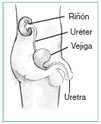 Diagrama de la vista lateral de las vías urinarias  masculinas. Las etiquetas se~alan el ri~ón, el uréter, la vejiga y la uretra.  Los órganos aparecen dentro de la silueta de un hombre joven desde la sección del  abdomen hasta el muslo.