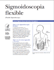 Sigmoidoscopia flexible publicación imagen