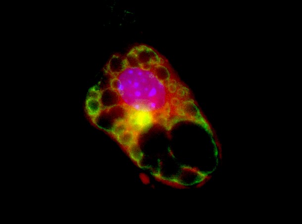 This is a photomicrograph of a brown fat cell (brown adipocyte) that was taken from a muscle stem cell (Image: Alessandra Pasut, Ottawa Hospital Research Institute)