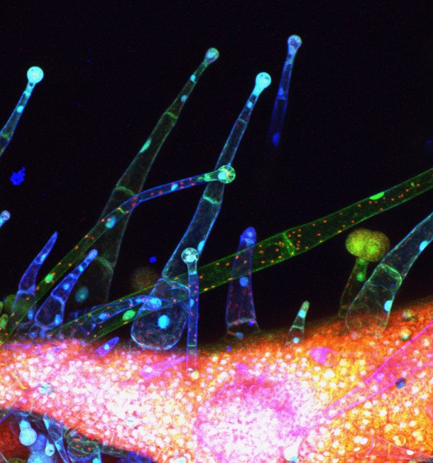 An extreme close up of a wild tomato’s trichomes, hair-like protrusions, that produce a mixture of special chemicals that shape the interactions between the plant and its environment some of which act as the first line of defense against pests. (Photo: Michigan State University)