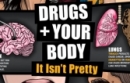 Drugs and Your Body: It Isn’t Pretty (Teaching Guide) Poster