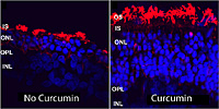 Curcumin prevents abnormal clustering of mutant rhodopsin.