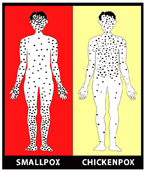 Rash Distribution