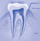 Diagram of a tooth and gums. - Click to enlarge in new window.