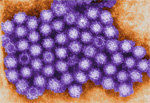 Norovirus