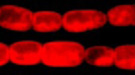 Fluorsecence micrograph of Nostoc showing heterocyst (box)