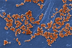 Staphylococcus aureus bacteria