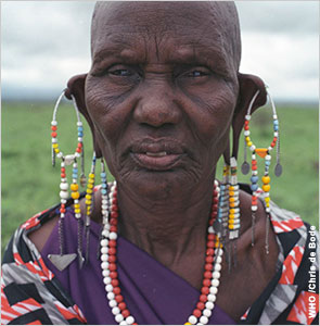 This Tanzanian woman is blinded by trachoma and unable to pursue her livelihood — making the kind of jewelry she wears.