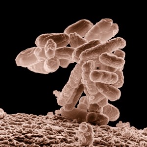 A cluster E. coli bacteria magnified 10,000 times. Georgia Tech researchers found and documented many types of bacteria, include E.coli, up in the middle to upper regions of the Troposphere. (Photo: USDA)