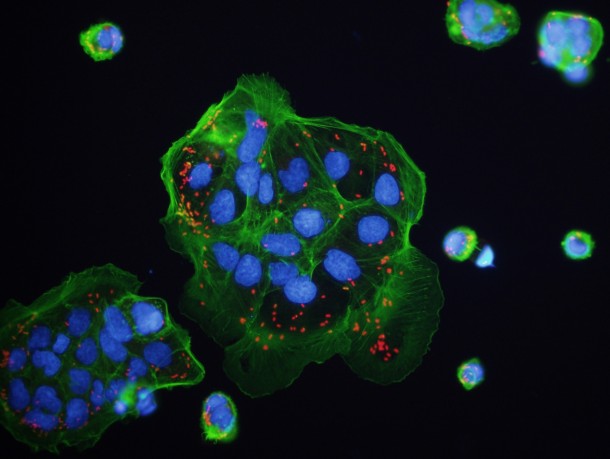 Immune system cells, called macrophages, normally engulf and kill intruding bacteria but sometimes the microbes, shown in red, find a way to escape into the interior of the cell where it can multiply and invade other cells.  (Photo: Miao lab, UNC School of Medicine)