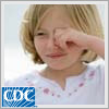 In this podcast, CDC's Adam Cohen, MD, a pediatrician and parent, discusses conjunctivitis (pink eye), a common eye condition in children and adults. He reviews pink eye causes and treatment, suggestions on when to call or visit a doctor, and practical tips to prevent pink eye from spreading.