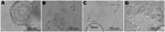 Thumbnail of Demonstration of cytopathic effect in infected tissue aggregates during the second infection trial. A) Uninfected aggregate, 24 h into the experiment. B) Cells infected with lysate from the first infection trial (P1) at 24 h postinfection. C) Stool sample flag2 at 24 s postinfection (P0). D) Stool sample 149 at 48 h postinfection (P0). Arrows indicate cells exhibiting unusual pathology.