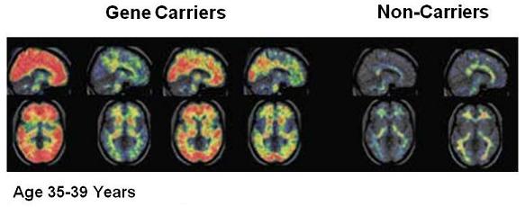 Picture of Gene Carriers vs. Non-Carriers, Age 35-39 Years