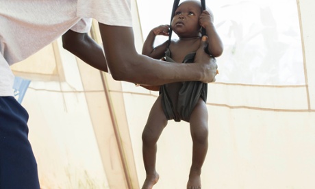 Child with suspected malnutrition is weighed in Malakal, South Sudan