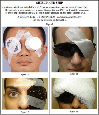 Different Examples of Eye Shields