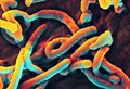 microscopic view of the ebola virus