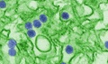 A digitally-colorized transmission electron micrograph of Zika virus, which is a member of the family Flaviviridae. Virus particles, here colored blue, are 40 nanometers in diameter with an outer envelope and an inner dense core. 