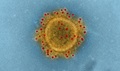 This image shows Middle East respiratory syndrome coronavirus particle envelope proteins immunolabeled with rabbit HCoV-EMC/2012 primary antibody and goat anti-rabbit 10-nanometer gold particles. (National Institute of Allergy and Infectious Disease photo)