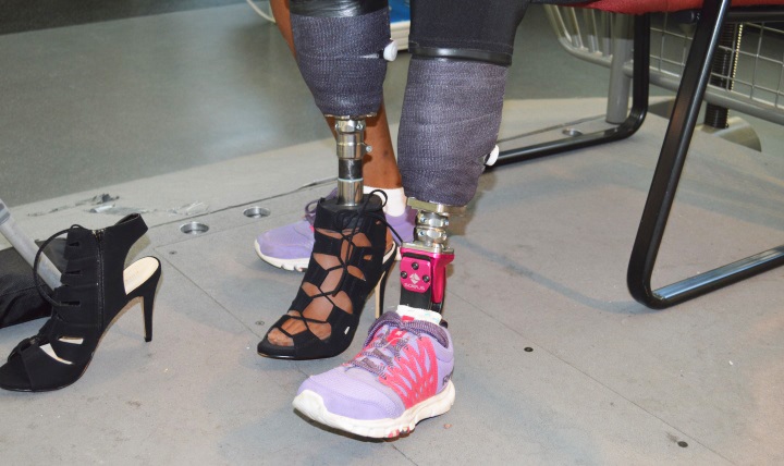 Army Spc. Cherdale Allen shows off two of her prosthetic legs: one for walking and the other for high heels.