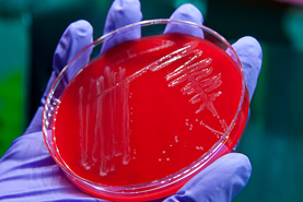 	a gloved hand holding a red petri dish