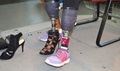 Army Spc. Cherdale Allen shows off two of her prosthetic legs: one for walking and the other for high heels.