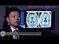 Dr. Heechin Chae on The Mystery of the Brain