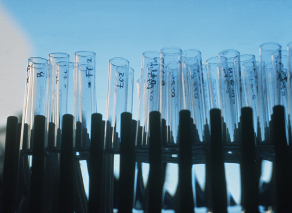 series of marked test tubes