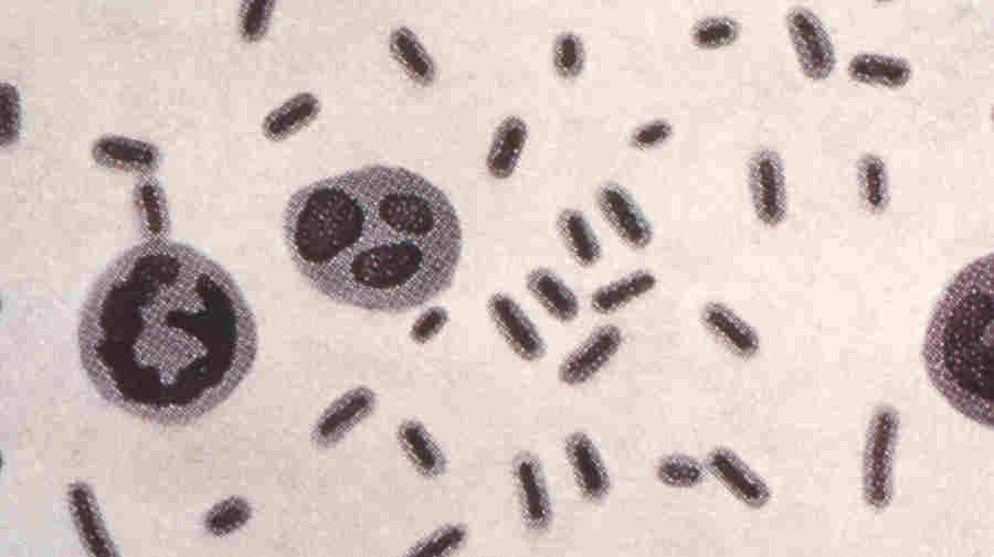 A Superbug That Resisted 26 Antibiotics