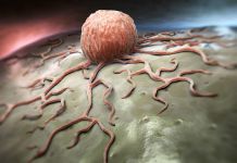 Gros plan sur une cellule cancéreuse (Shutterstock)