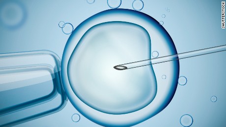 An illustration representing the IVF process. 